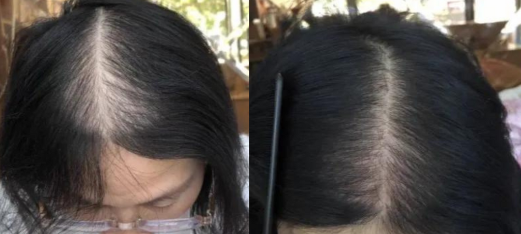 Lustrao Complete Regrowth System 🌿